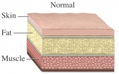 Composition of human skin